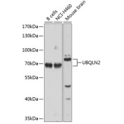 Western blot analysis of extracts of various cell lines using UBQLN2 Antibody (1/1000 dilution).