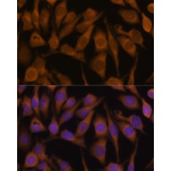 Ubiquilin-2 (UBQLN2) Antibody