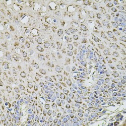 Transmembrane Channel-Like Protein 1 (TMC1) Antibody
