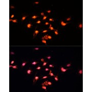 Immunofluorescence analysis of C6 cells using GTF3C4 Antibody (1/100 dilution, 40x lens). Blue: DAPI for nuclear staining.