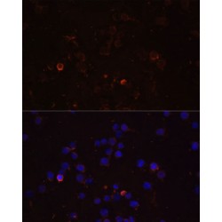 Toll Like Receptor 4 (TLR4) Antibody