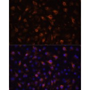 Immunofluorescence analysis of RAW264.7 cells using TLR4 Antibody (1/100 dilution, 40x lens). Blue: DAPI for nuclear staining.