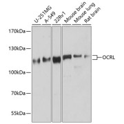 Western blot analysis of extracts of various cell lines using OCRL Antibody (1/1000 dilution).