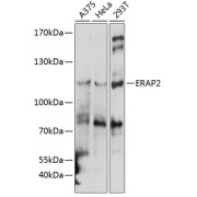 Western blot analysis of extracts of various cell lines using ERAP2 Antibody (1/1000 dilution).