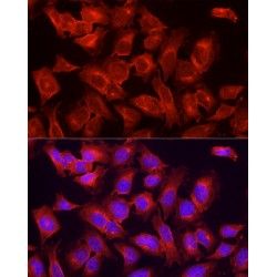 Serine/threonine-Protein Kinase ULK1 (ULk1) Antibody