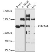Western blot analysis of extracts of various cell lines using CLEC16A Antibody (1/1000 dilution).