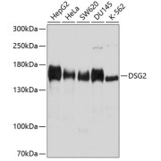 Western blot analysis of extracts of various cell lines using DSG2 Antibody (1/1000 dilution).