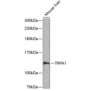 Western blot analysis of extracts of Mouse liver using TRPA1 Antibody (1/1000 dilution).