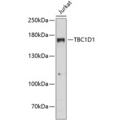 Western blot analysis of extracts of Jurkat cells using TBC1D1 Antibody (1/3000 dilution).