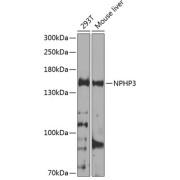 Western blot analysis of extracts of various cell lines using NPHP3 Antibody (1/1000 dilution).