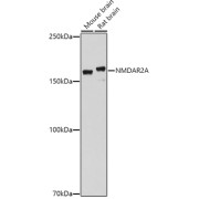 Western blot analysis of extracts of various cell lines using NMDAR2A Antibody (1/1000 dilution).