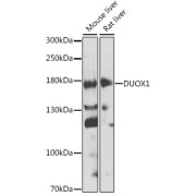 Western blot analysis of extracts of various cell lines using DUOX1 Antibody (1/1000 dilution).