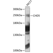 Western blot analysis of extracts of MCF-7 cells using CHD5 Antibody (1/1000 dilution).