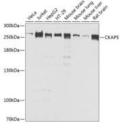 Western blot analysis of extracts of various cell lines using CKAP5 Antibody (1/1000 dilution).