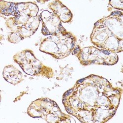 Vascular Endothelial Growth Factor Receptor 1 (FLT1) Antibody