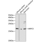 Western blot analysis of extracts of various cell lines using ARPC5 Antibody (1/1000 dilution).