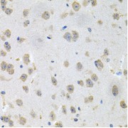 Immunohistochemistry of paraffin-embedded Mouse brain using GNE Antibody (1/100 dilution, 40x lens).