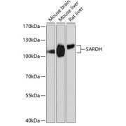 Western blot analysis of extracts of various cell lines using SARDH Antibody (1/3000 dilution).