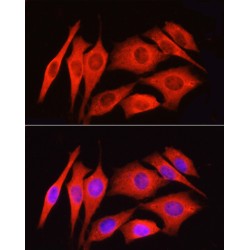 Proteinase-Activated Receptor 2 / PAR2 (F2RL1) Antibody