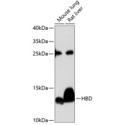Western blot analysis of extracts of various cell lines using HBD Antibody (1/3000 dilution).