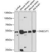 Western blot analysis of extracts of various cell lines using ONECUT1 Antibody (1/3000 dilution).