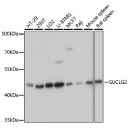Western blot analysis of extracts of various cell lines using SUCLG2 Antibody (1/3000 dilution).