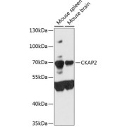 Western blot analysis of extracts of various cell lines using CKAP2 Antibody (1/3000 dilution).