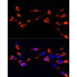 Malignant T-Cell Amplified Sequence 1 (MCTS1) Antibody