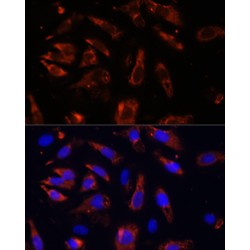 Malignant T-Cell Amplified Sequence 1 (MCTS1) Antibody