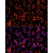 Immunofluorescence analysis of C6 cells using MCTS1 Antibody (1/100 dilution, 40x lens). Blue: DAPI for nuclear staining.
