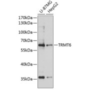 Western blot analysis of extracts of various cell lines using TRMT6 Antibody (1/3000 dilution).