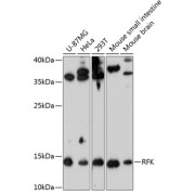 Western blot analysis of extracts of various cell lines using RFK Antibody (1/3000 dilution).