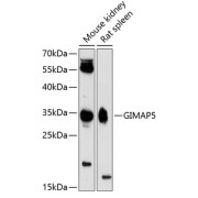 Western blot analysis of extracts of various cell lines using GIMAP5 Antibody (1/3000 dilution).