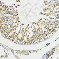 HECT Domain And Ankyrin Repeat Containing E3 Ubiquitin Protein Ligase 1 (HACE1) Antibody