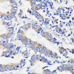 DEP Domain-Containing Protein 6 (DEPDC6) Antibody