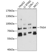 Western blot analysis of extracts of various cell lines using TNS4 Antibody (1/3000 dilution).