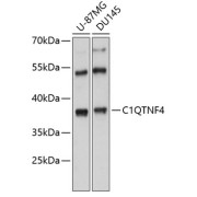 Western blot analysis of extracts of various cell lines using C1QTNF4 Antibody (1/3000 dilution).