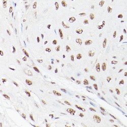 RNA Polymerase-Associated Protein LEO1 (LEO1) Antibody