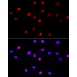 RNA Polymerase-Associated Protein LEO1 (LEO1) Antibody