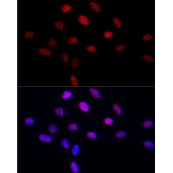 RNA Polymerase-Associated Protein LEO1 (LEO1) Antibody