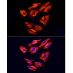 Nephrocystin 4 (NPHP4) Antibody