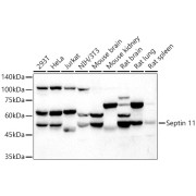 Western blot analysis of extracts of various cell lines using Septin 11 Antibody (1/5000 dilution).