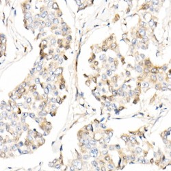 Apoptosis Inducing Factor, Mitochondria Associated 2 (AIFM2) Antibody