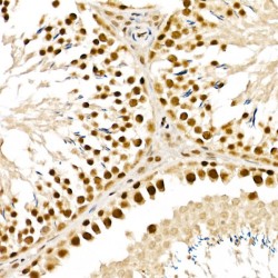 AlkB Homolog 5, RNA Demethylase (ALKBH5) Antibody