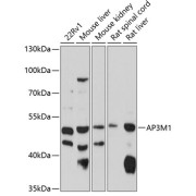 Western blot analysis of extracts of various cell lines using AP3M1 Antibody (1/1000 dilution).