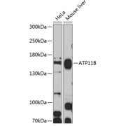 Western blot analysis of extracts of various cell lines using ATP11B Antibody (1/1000 dilution).
