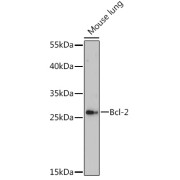 Western blot analysis of extracts of Mouse lung using Bcl-2 Antibody (1/500 dilution).