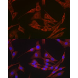 Apoptosis Regulator Bcl-2 (BCL2) Antibody