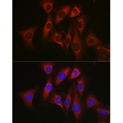 Apoptosis Regulator Bcl-2 (BCL2) Antibody