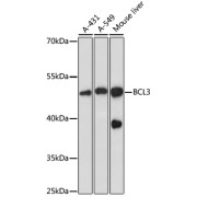 Western blot analysis of extracts of various cell lines using BCL3 Antibody (1/1000 dilution).